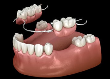 Prosthodontics