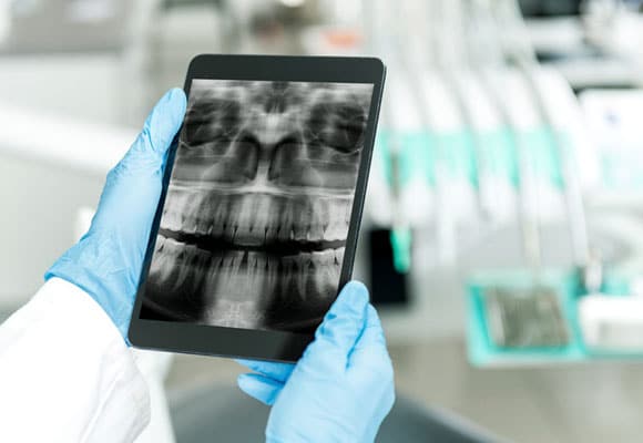 Digital x-rays
