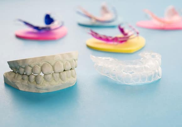orthodontic treatment