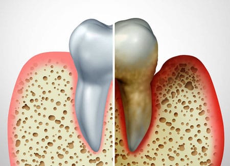 Periodontics