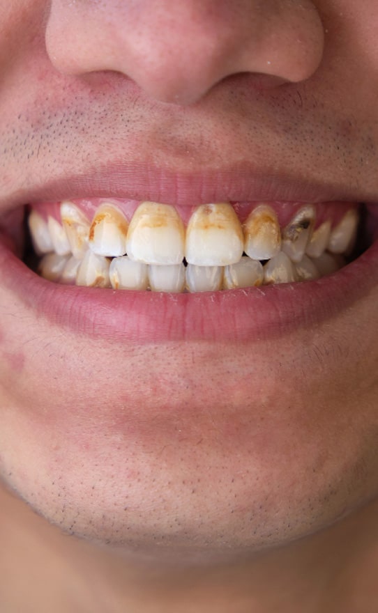 Oral Health
