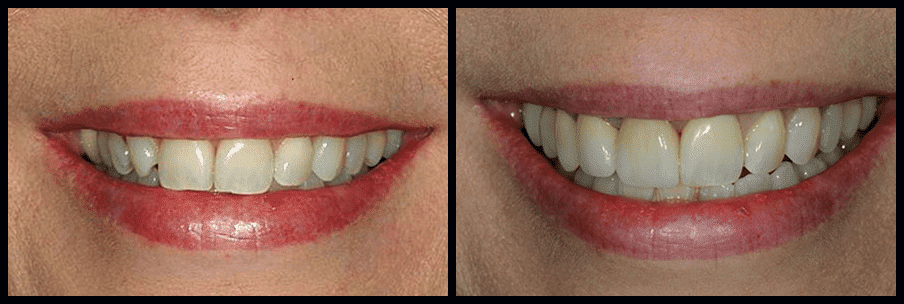smile-gallery (1)