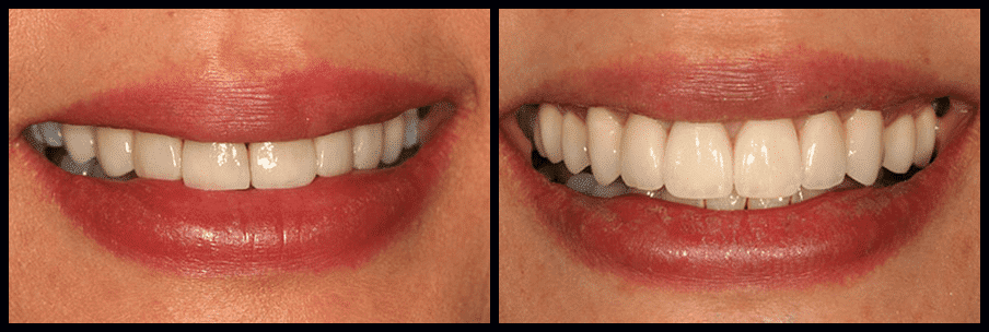 smile-gallery (2)