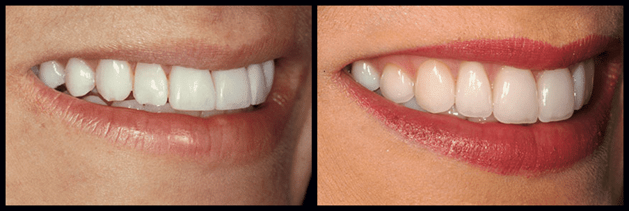 smile-gallery (3)