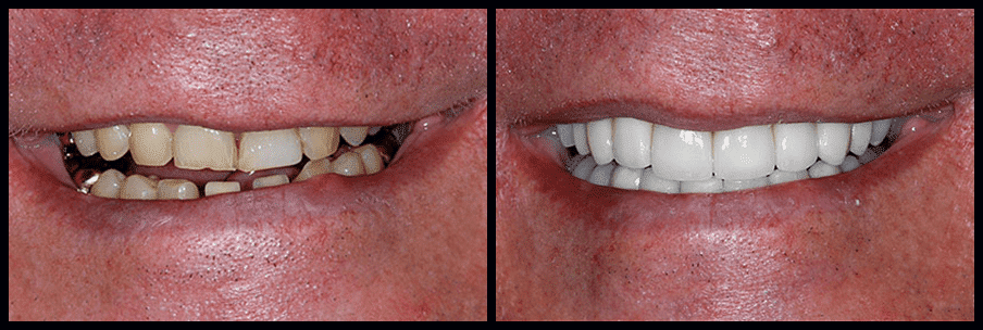 smile-gallery (4)