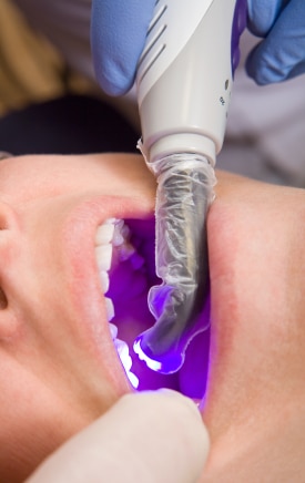 Featured image for “What Materials Make up Composite Fillings?”