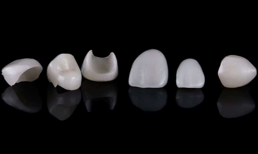 Featured image for “Porcelain Veneers for Sensitive Teeth: A Gentle Cosmetic Solution”