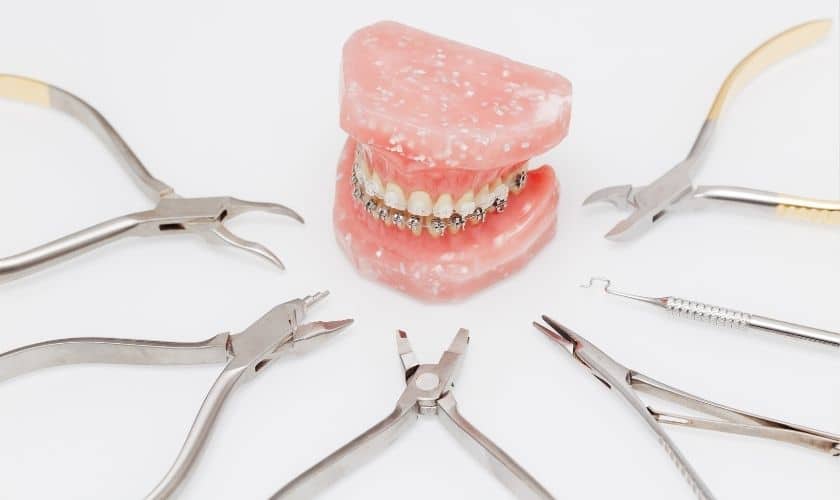 Featured image for “Different Types of Orthodontic Treatments”