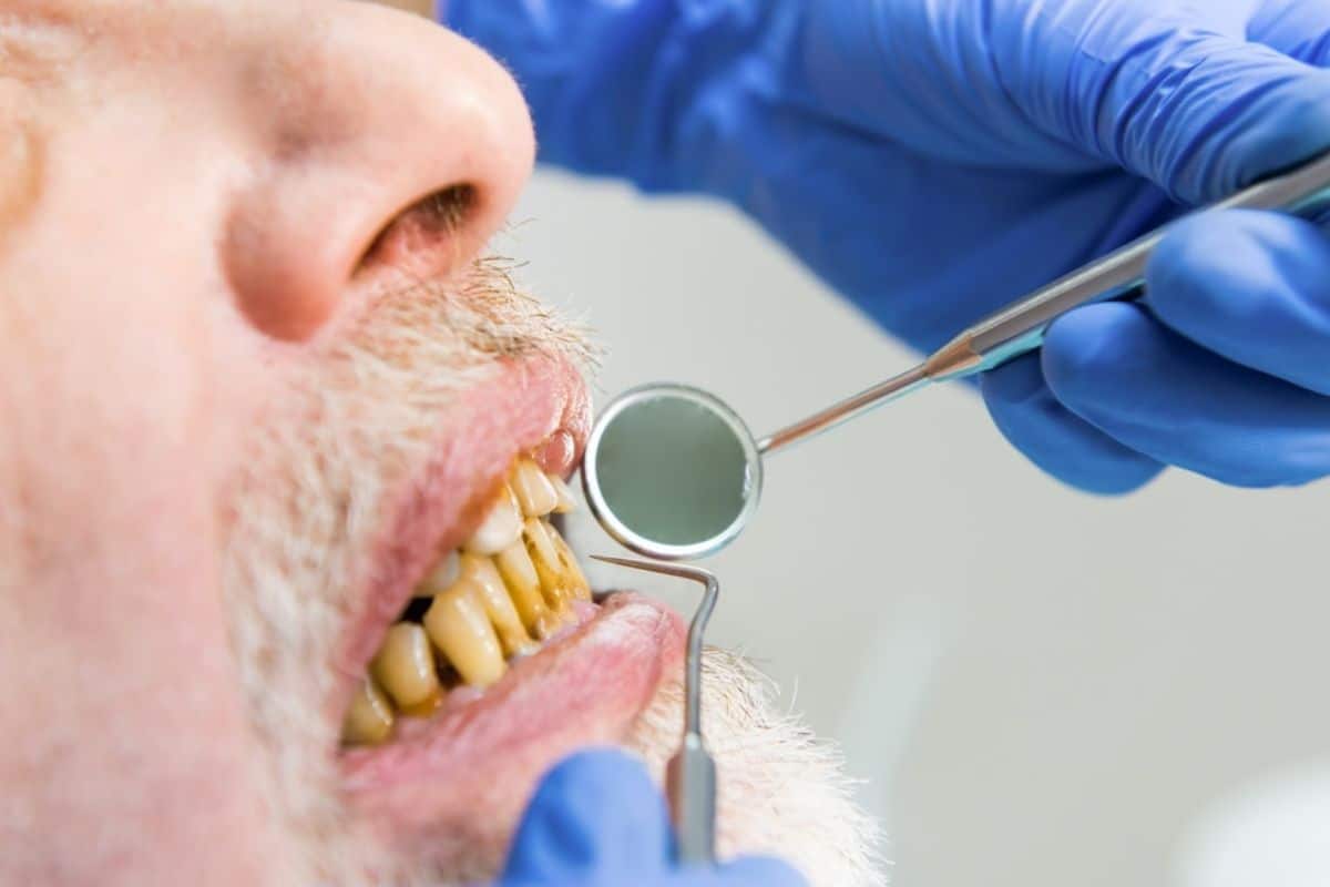 Featured image for “What’s Causing Your Tooth to Change Color?”
