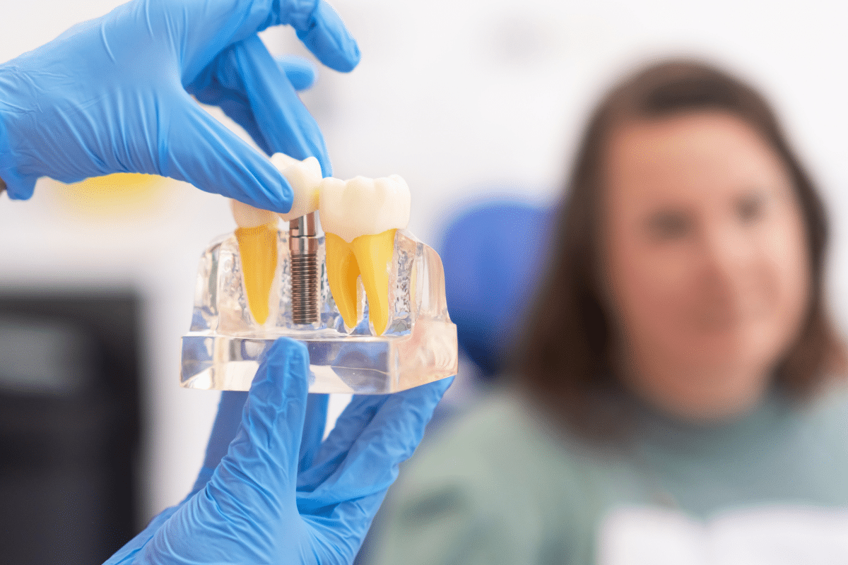 Featured image for “Dental Implants: The Permanent Answer to Missing Teeth”