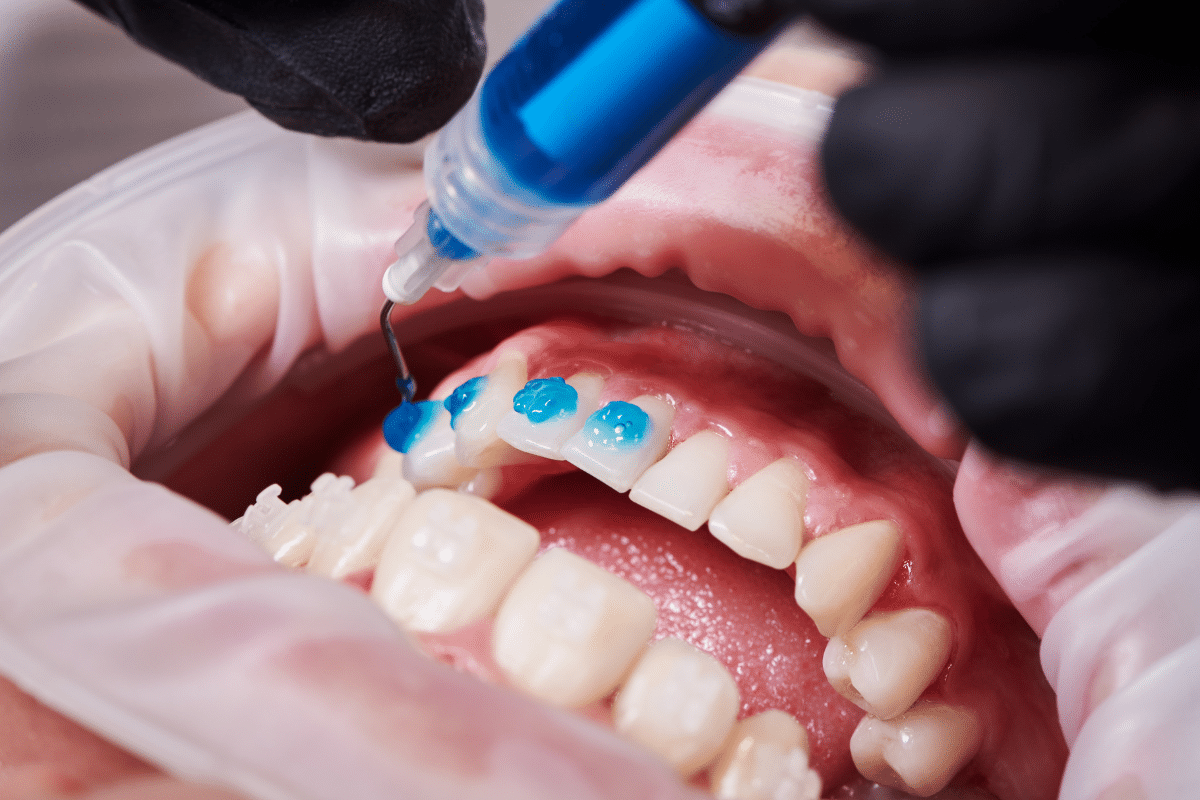 Featured image for “Transform Your Look with Advanced Cosmetic Dentistry Treatments”