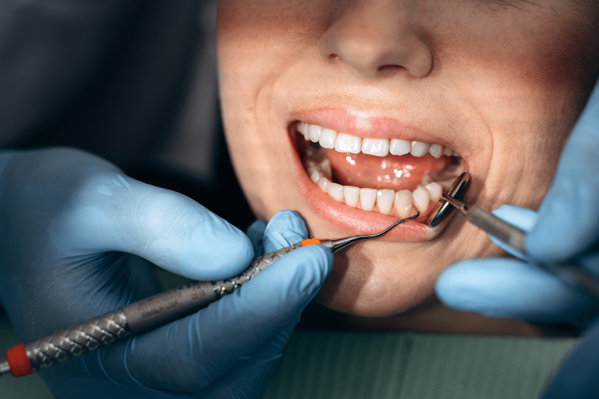 Featured image for “Professional Dental Services for Long-Lasting Oral Health”