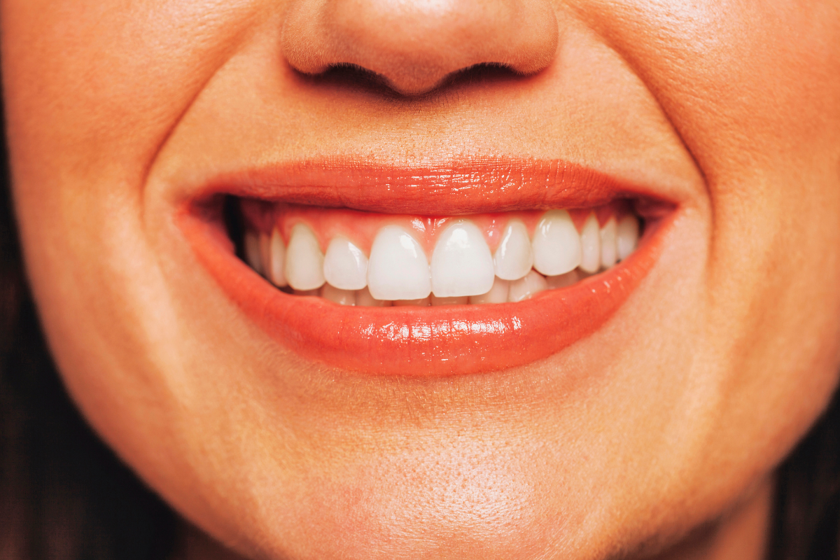 Featured image for “Improve Your Smile and Confidence with Professional Cosmetic Dentistry”