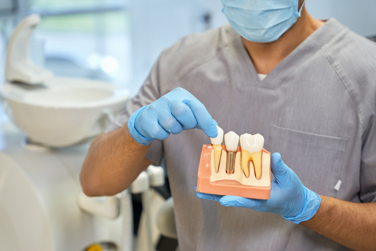 Featured image for “Transform Your Smile with Reliable and Natural-Looking Dental Implants”